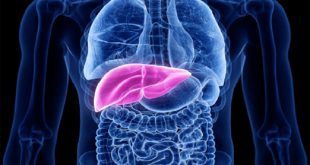 سرطان الكبد